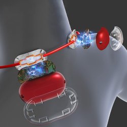 EMS NAKKEMASSAGER MT6534